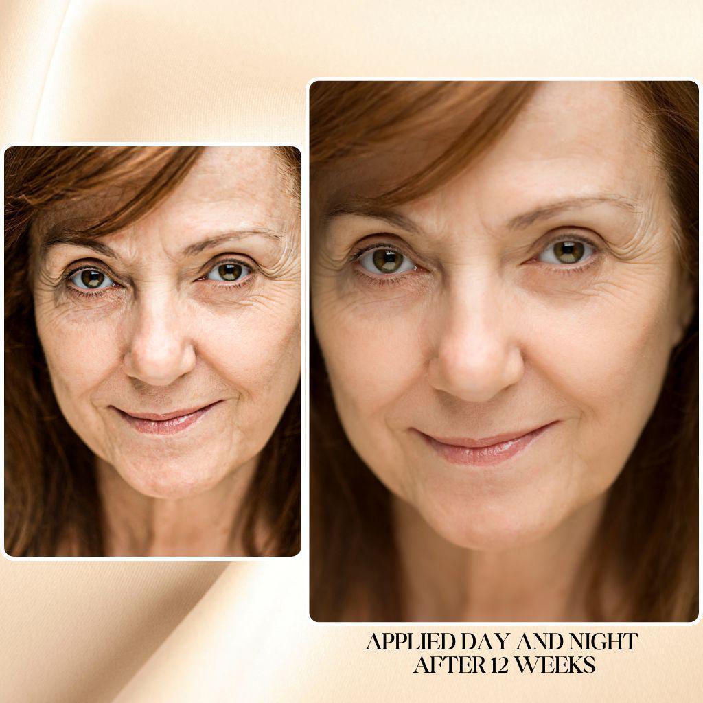 Anti-Aging Bundle, Large